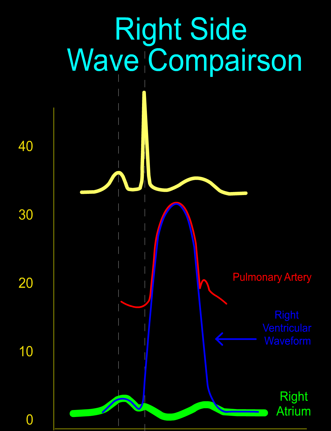 ride-side-wave-comparison
