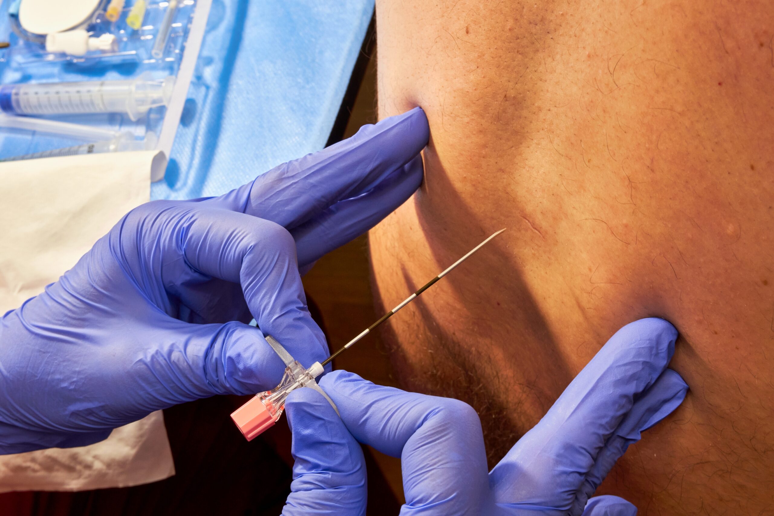 Anesthesia complication potential cardiac arrest cause.