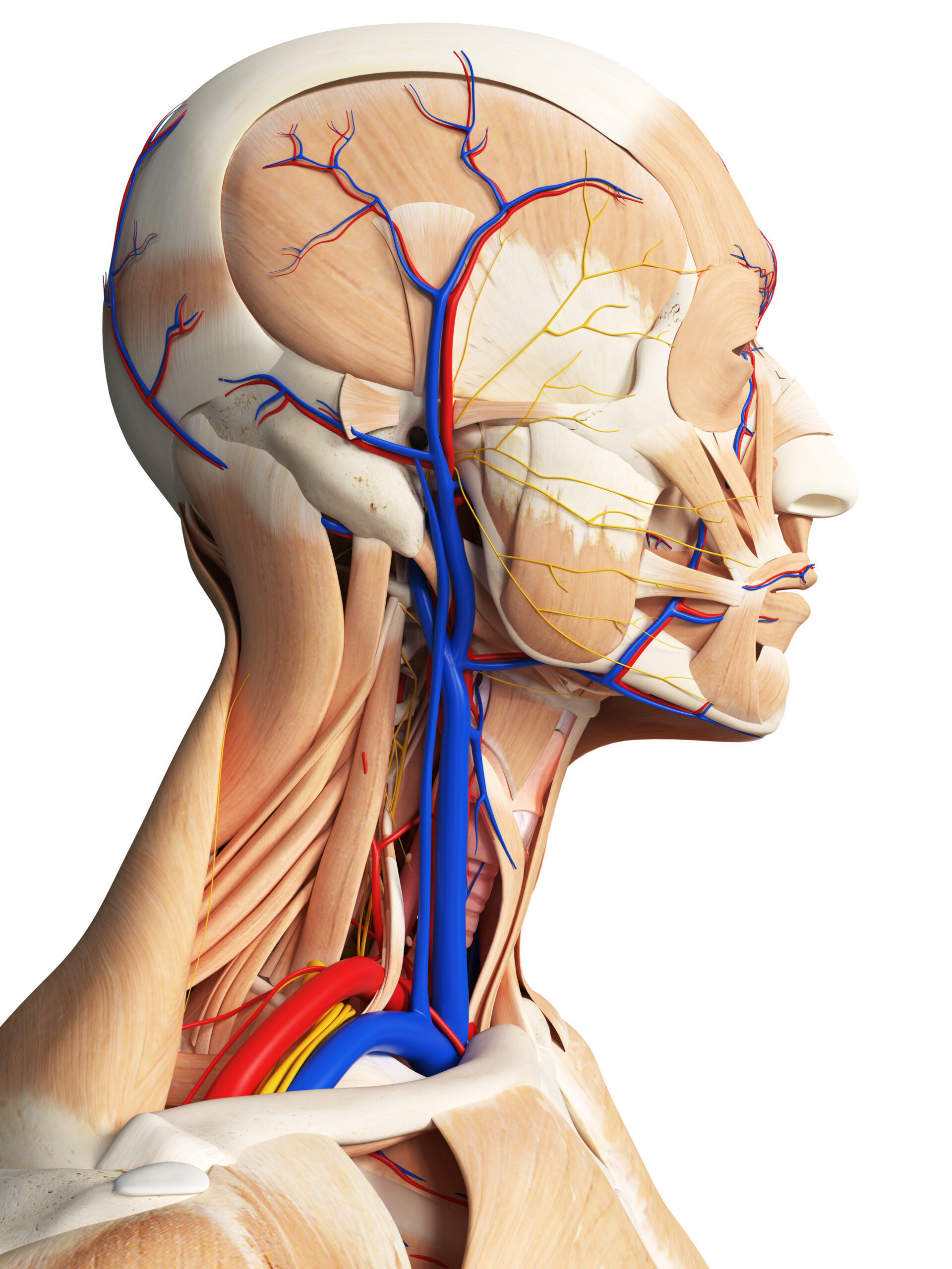 Jugular vein distention.