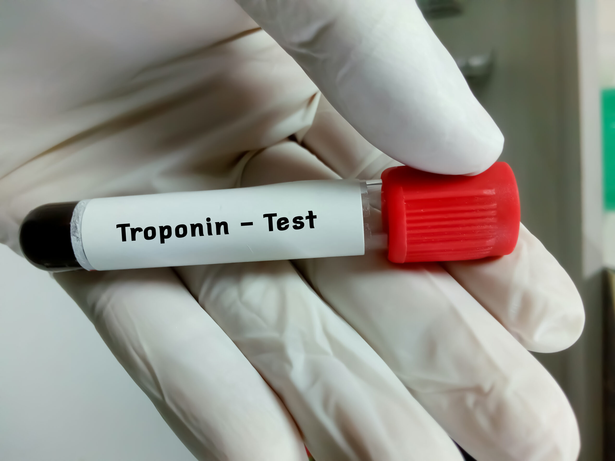 Troponin test vial.