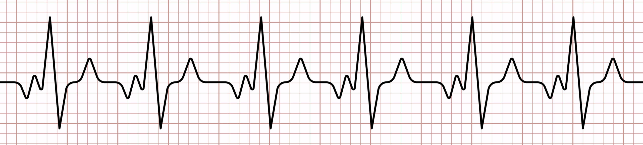 12-lead ECG evaluates heart’s electrical activity.