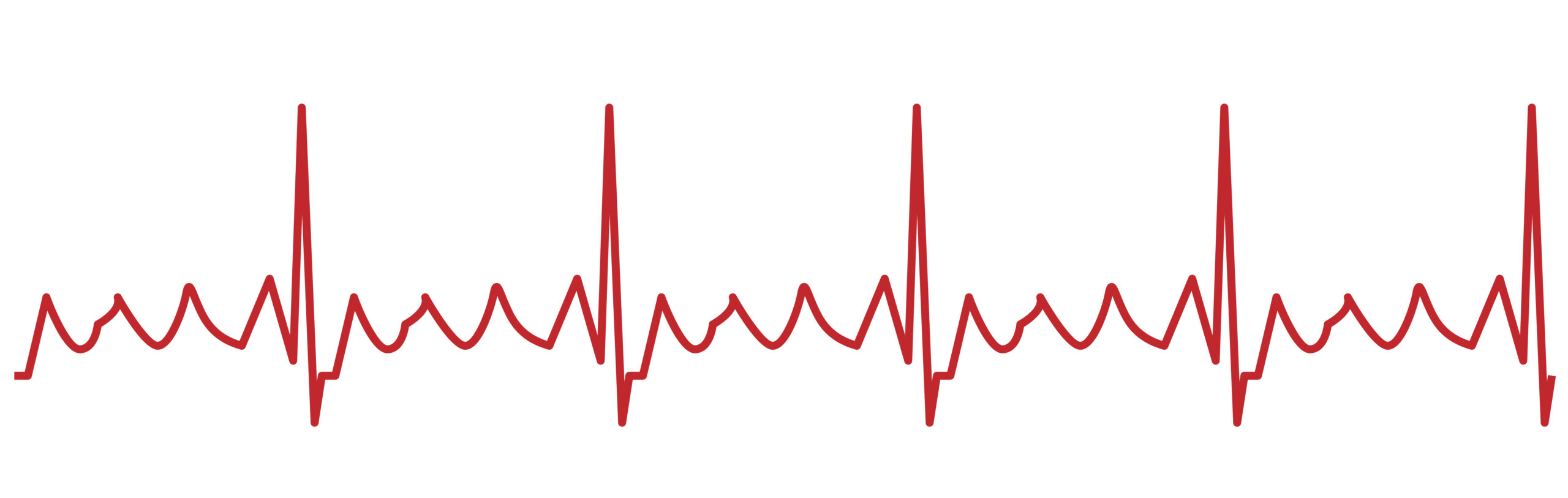 Atrial flutter “saw-tooth” on ECG.