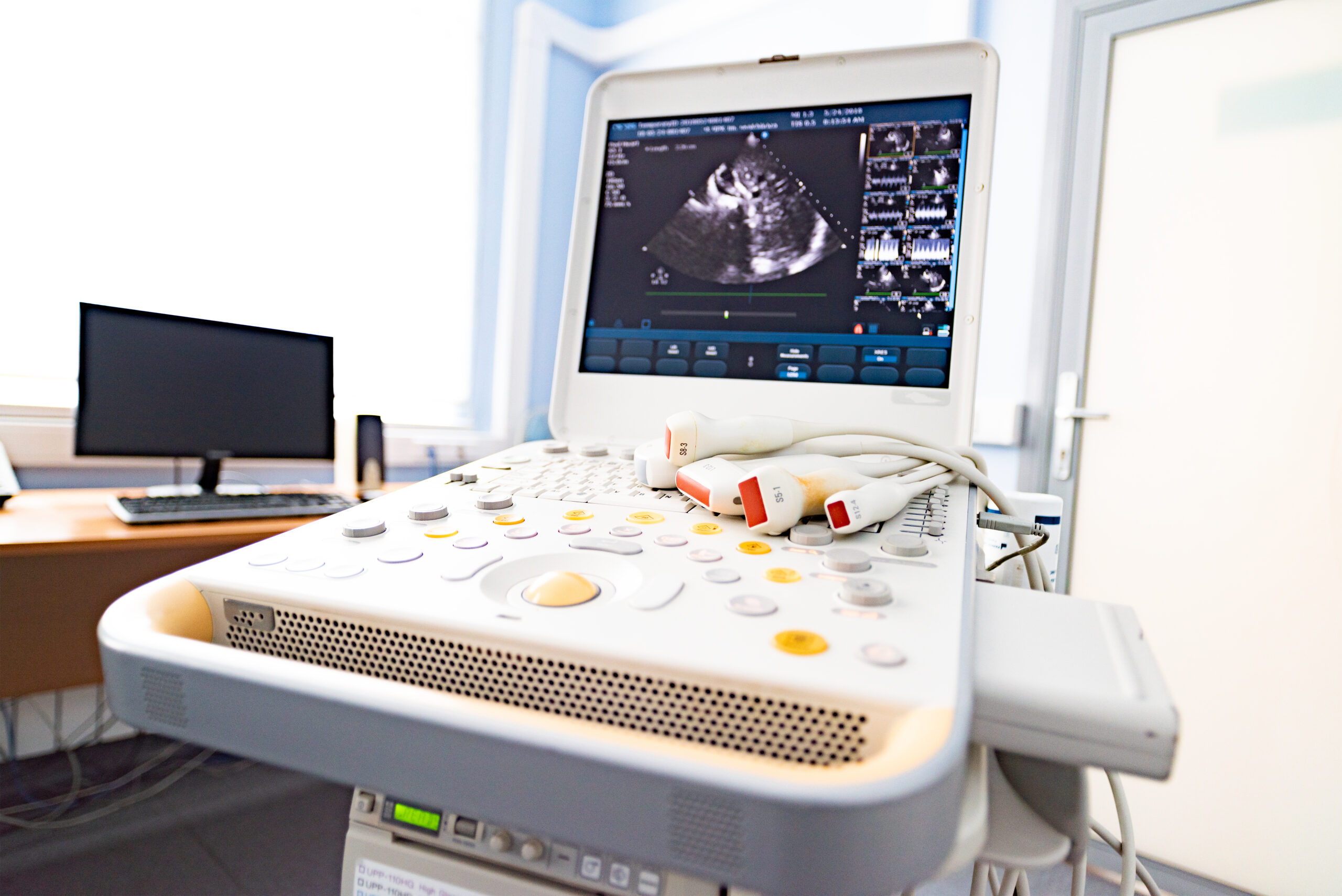 Child’s heart echocardiogram.