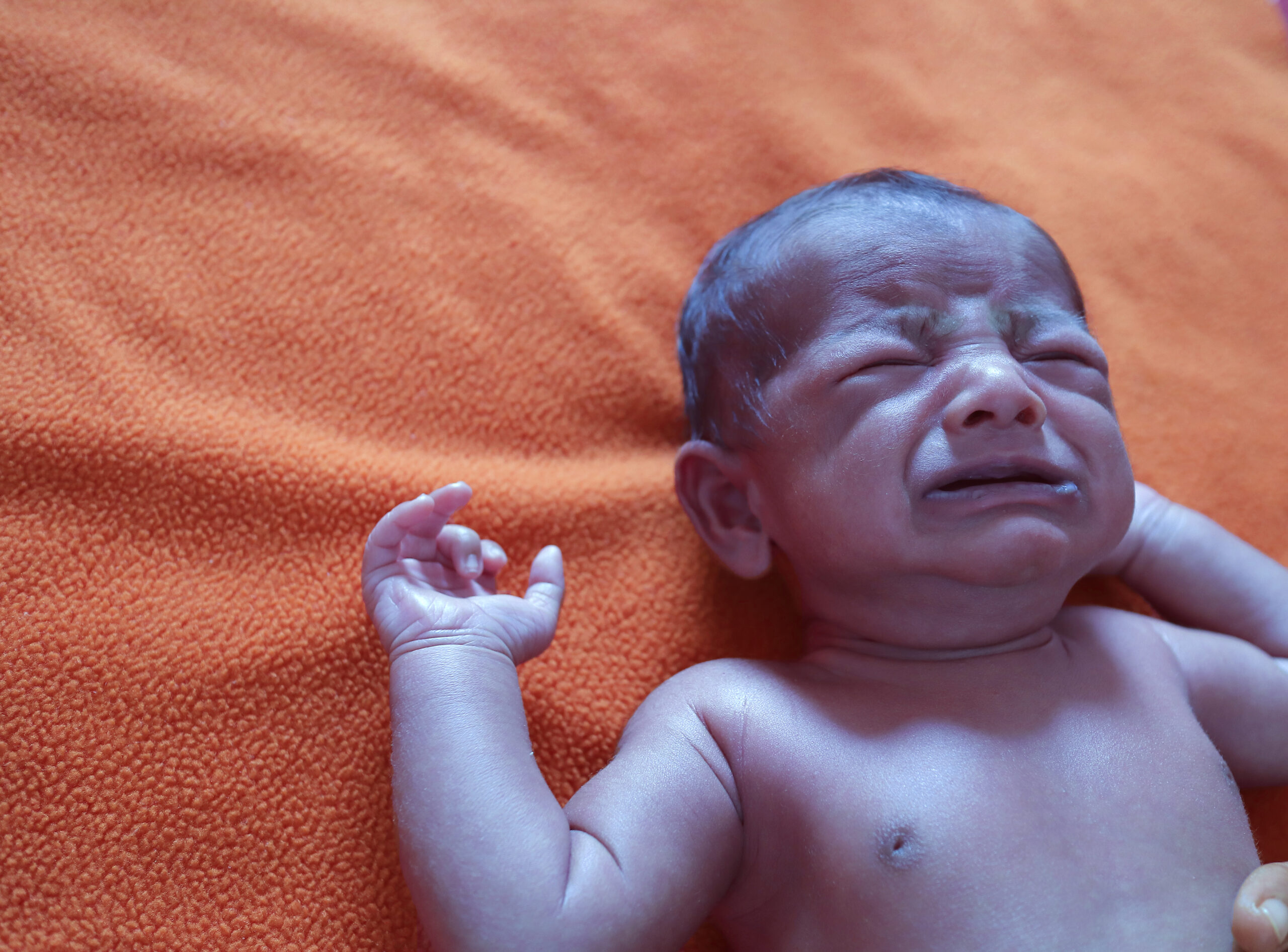 Infant cyanosis.