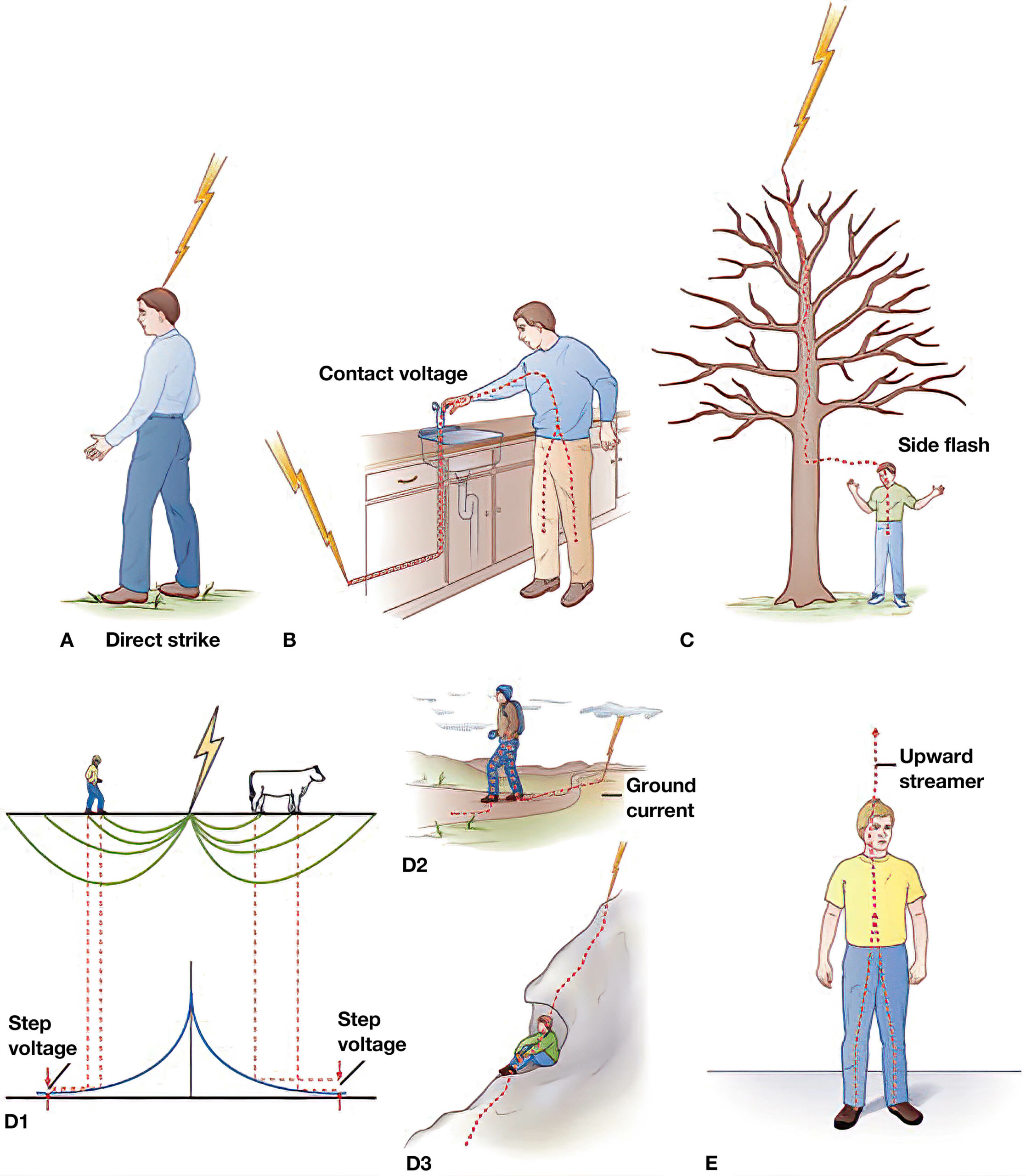Types of lightning injuries.