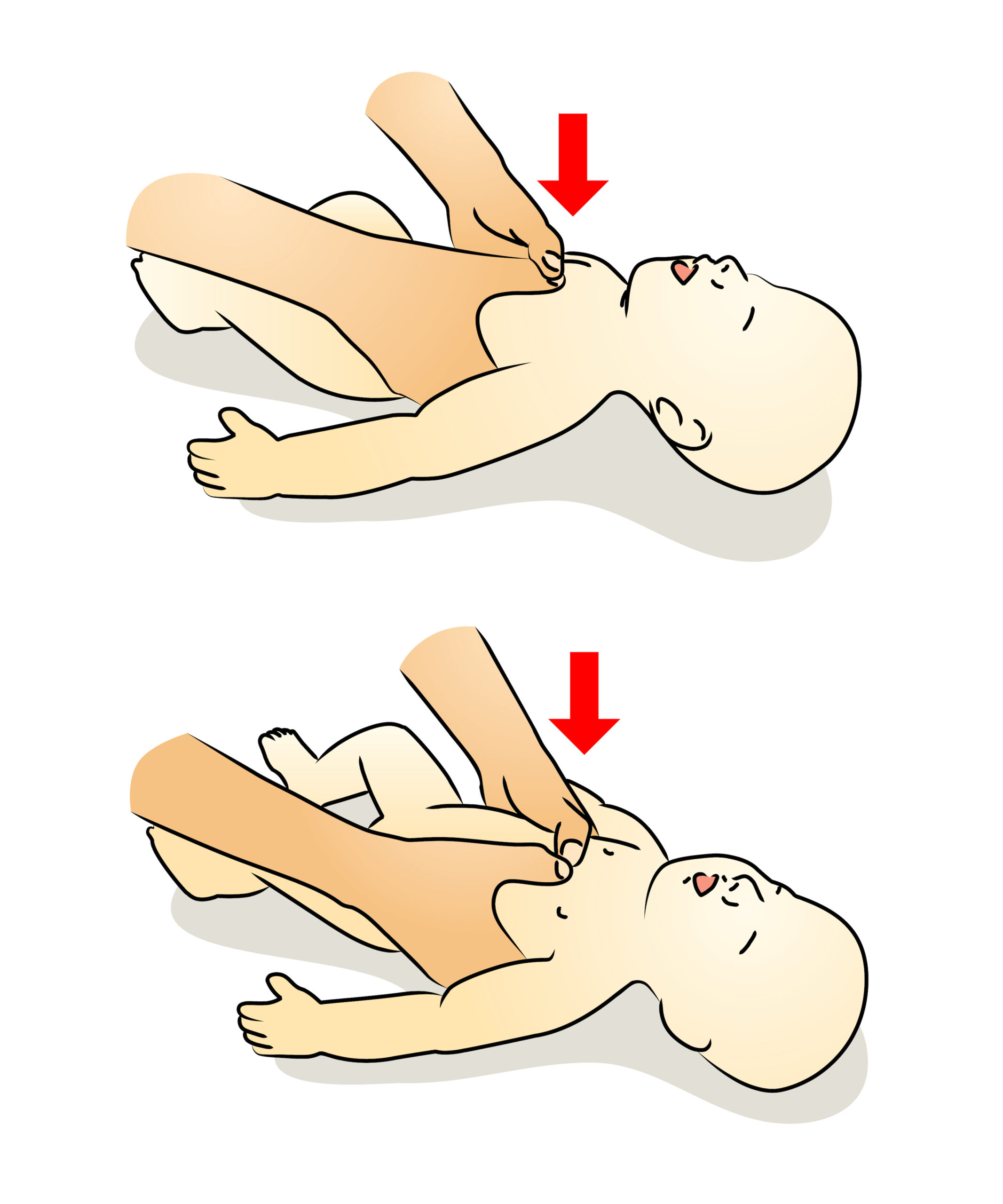 Thumbs on an infant's chest performing compressions.
