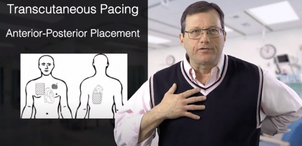 Transcutaneous Pacing | ACLS Resources | ACLS Certification Association
