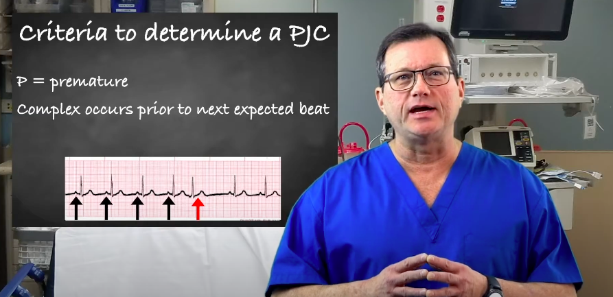Criteria for PJCs (Premature Junctional Contractions)