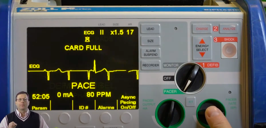 Setting pacer to 80 ppm with 0 mA.